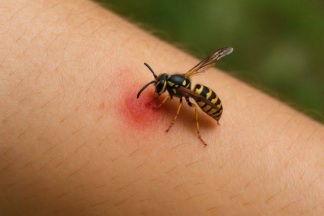 Action de la chaleur après une piqûre de guêpe ou de frelon.