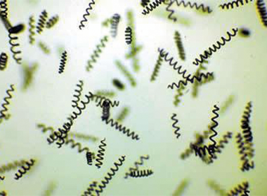 Spiruline de l’Essen’Ciel