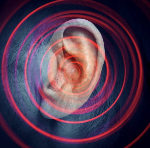Acouphènes Vous percevez constamment des sons internes, tels que des sifflements ou des bourdonnements , qui ne proviennent pas de sources